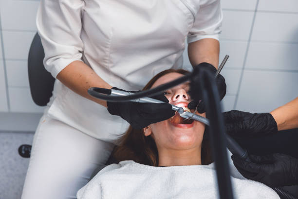Best Emergency Tooth Extraction in Syracuse, NY